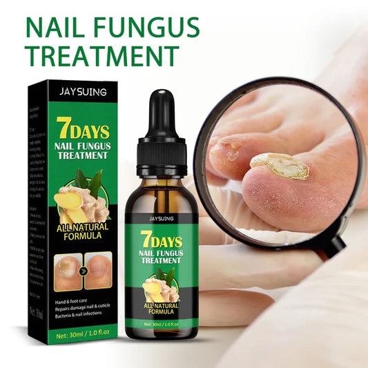 Compra 1 y llevate 2👋🦠Anti Hongos Uñas - 7 Days™  2UND 30ml
