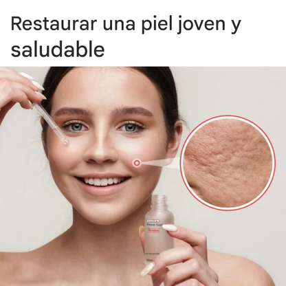 Compra 1 y llevate 2 🌟The Ordinary®  Niacinamide 10% + Zinc 1%, 30 ml✨ 2x1